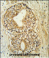 ATP11C Antibody (Center)